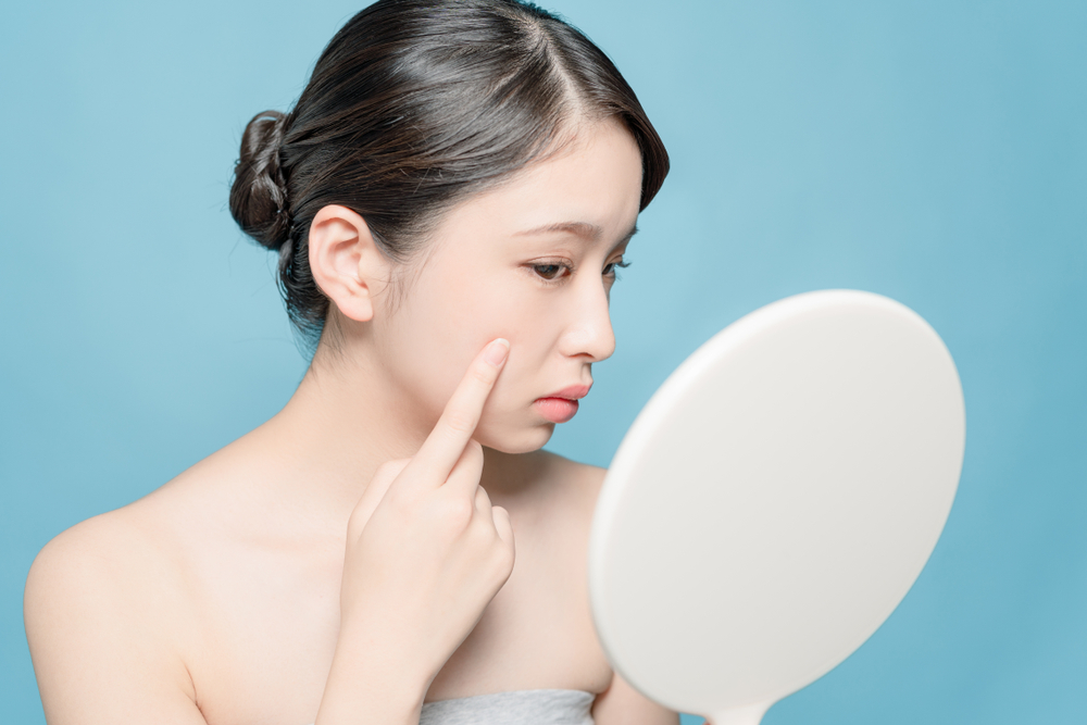 肌質・体質別に見るシミができやすい人の特徴